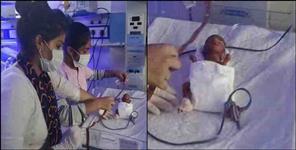 image: Youngest child born in India admitted in kashipur uttarakhand