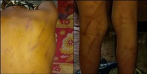image: 7-year-old quit school after brutally beaten by teacher