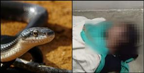 image: Woman dies of snake bite in pratapnagar