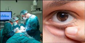 image: Successful surgery of first eye tumor patient of Uttarakhand