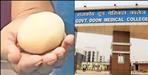 Joint peritoneal mouse in abdomen of old man