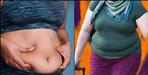 Obesity is increasing among women of Uttarakhand latest health survey report