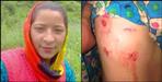 Chamoli vaan village Radha fought with bear