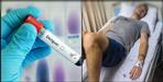 Dengue spread in 10 districts of Uttarakhand