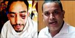 Aam Aadmi Party leader accused of beating youth in Almora