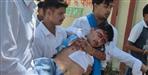 Bageshwar College Clash Leaves NSUI Worker Injured