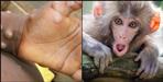 Monkeypox alert in Uttarakhand know Symptoms and Prevention