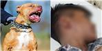 Pitbull enjured primary school innocent child in haridwar