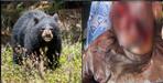 Bear attack on youth in Pauri Garhwal