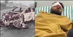 rishabh pant car accident video