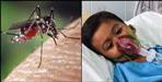 falciparum virus in Uttarakhand know Symptoms and prevention