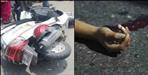 Scooty trolla collision in Champawat death of Neha Joshi