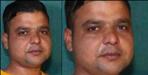 Youth died in Dehradun de-addiction center