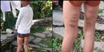 Teachers beat student in okhalkanda school
