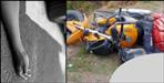 Truck hit the bike in Almora