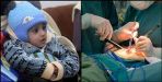 Successful surgery of one year old child made a diet tube