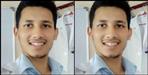 MBBS student commits suicide in Dehradun