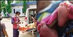 3-year-old boy fell in boiling water in Haldwani