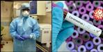 One and a half year old Coronavirus positive in Nainital
