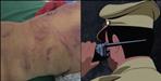 Dehradun Man Alleges Brutal Assault Police Launch Investigation