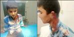 Father and son cut off the ear of a minor with sickle