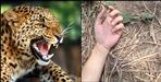 Leopard attack on Diksha of Khatima