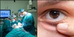 Successful surgery of first eye tumor patient of Uttarakhand