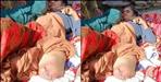 Woman loses leg due to negligence of doctors