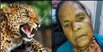 Guldar attacked woman in Pithoragarh