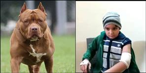 image: Haridwar pitbull dog attacked child