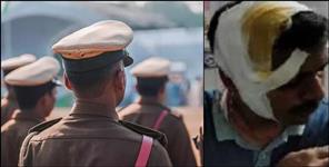 image: Drunk constable broke head of young man in Dehradun