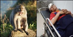 image: Vinita Nautiyal injured in monkey attack in Guptkashi
