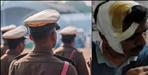 Drunk constable broke head of young man in Dehradun
