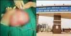 Rare Tumor Successfully Removed at Doon Hospital