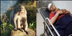 Vinita Nautiyal injured in monkey attack in Guptkashi